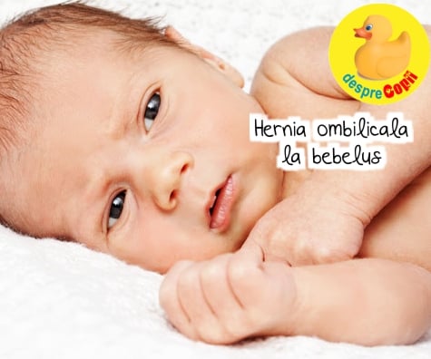 Hernia ombilicala la bebelus