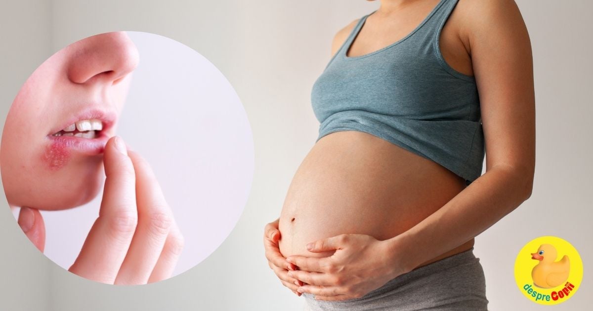 Herpesul in sarcina: simptome, transmitere si precautii  - sfatul medicului