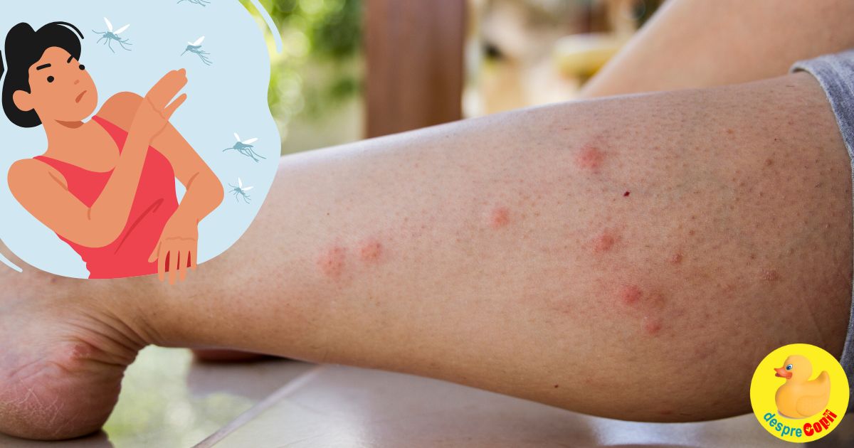 Vara, sezonul intepaturilor de insecte