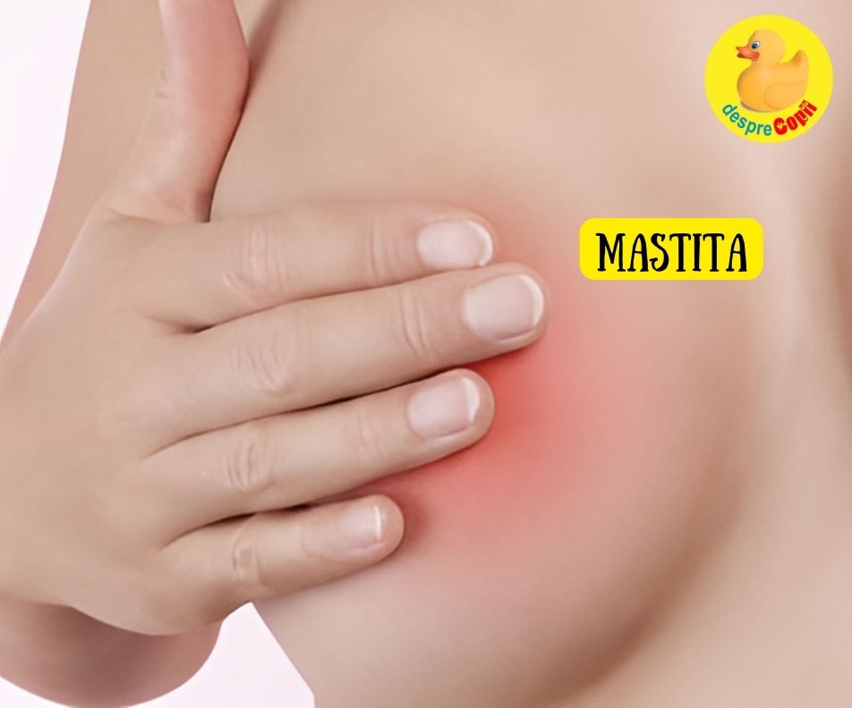 Mastita si blocarea ductelor sanului - simptome, tratament si prevenire