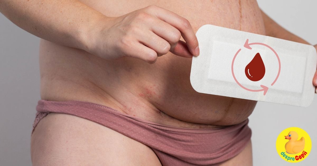 Prima menstruatie dupa cezariana - jurnal postpartum
