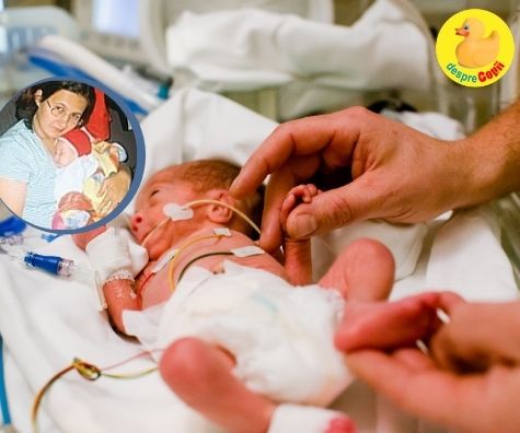 Diagnosticul la nastere a fost foarte grav iar Alex a fost un luptator insa numai noi - parintii, am crezut in el. SI a reusit dupa o nasterea prematura la 32 de saptamani