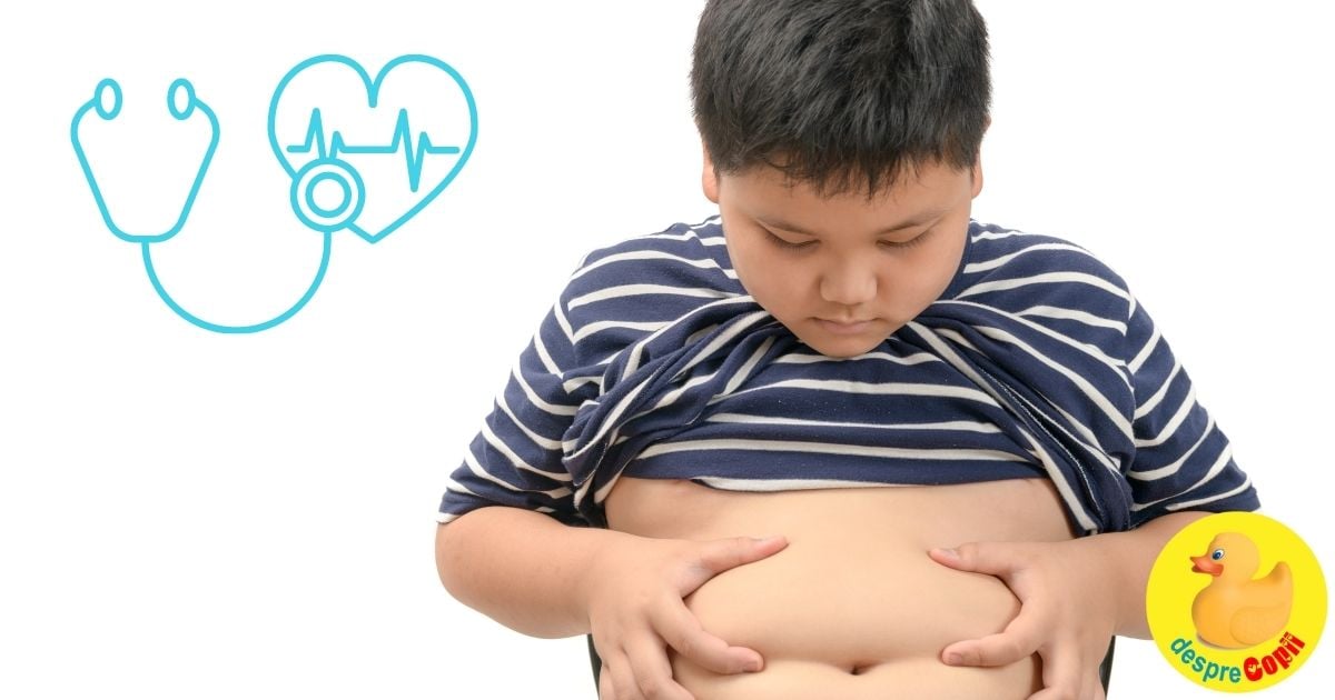 Obezitatea la copil: diagnostic, cauze, efecte si tratament