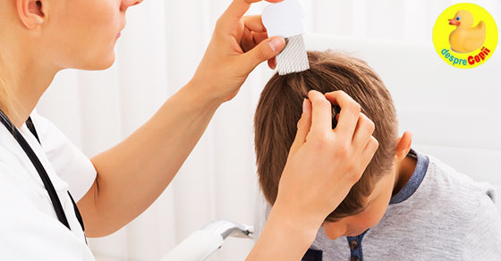Care sunt riscurile folosirii unor metode traditionale pentru eliminarea paduchilor de cap