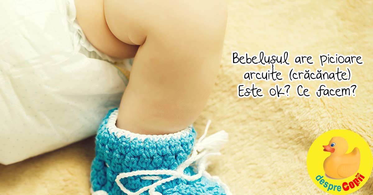 Bebelusul are picioare arcuite (cracanate) si alte ingrijorari legate de picioarele bebelusului: situatii si recomandari
