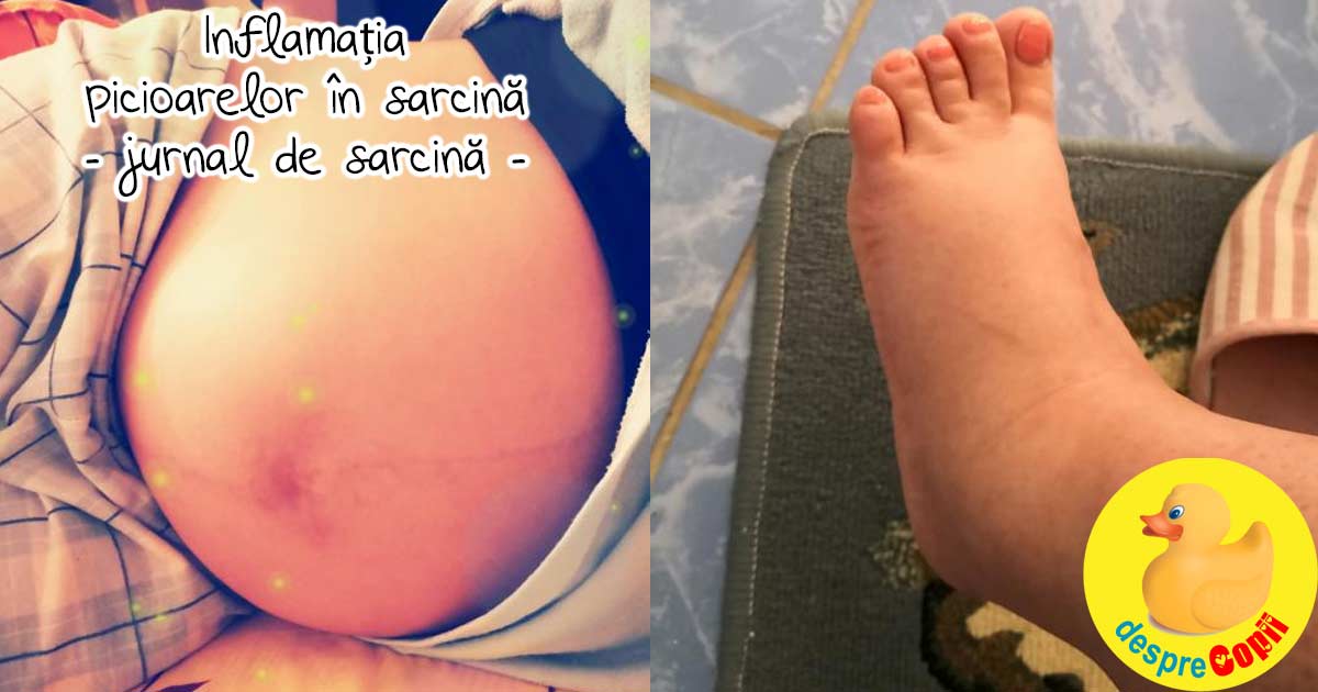 Inflamatia picioarelor in sarcina: iata ce am facut - jurnal de sarcina