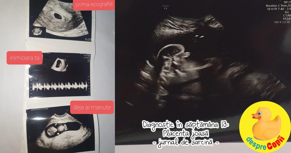 Diagnostic in saptamana 13 -  placenta joasa - jurnal de sarcina