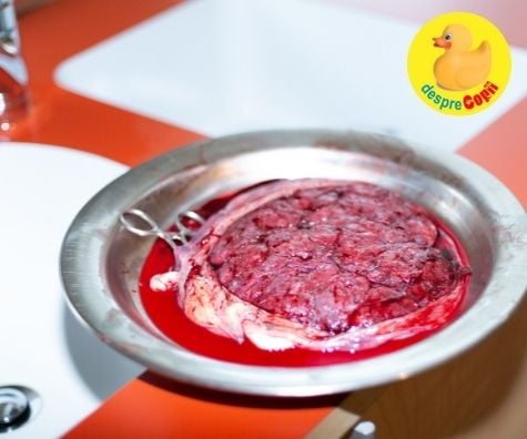 Placentofagia sau mancarea placentei - 4 motive pentru care aceste mame au mancat placenta bebelusului lor