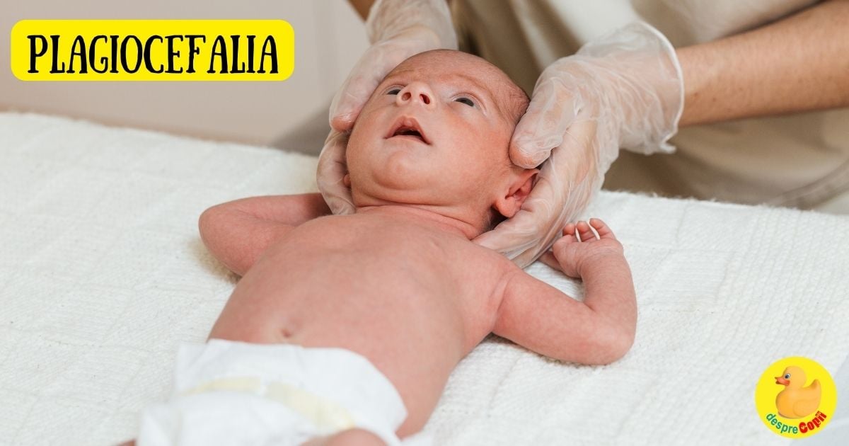 Plagiocefalia: iata cum poți preveni și trata aplatizarea craniului la bebeluși