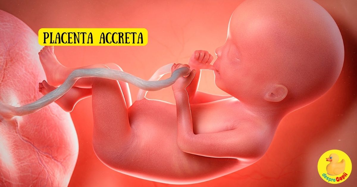 Placenta accreta -  cauze, prevenire si tratament - sfatul medicului ginecolog