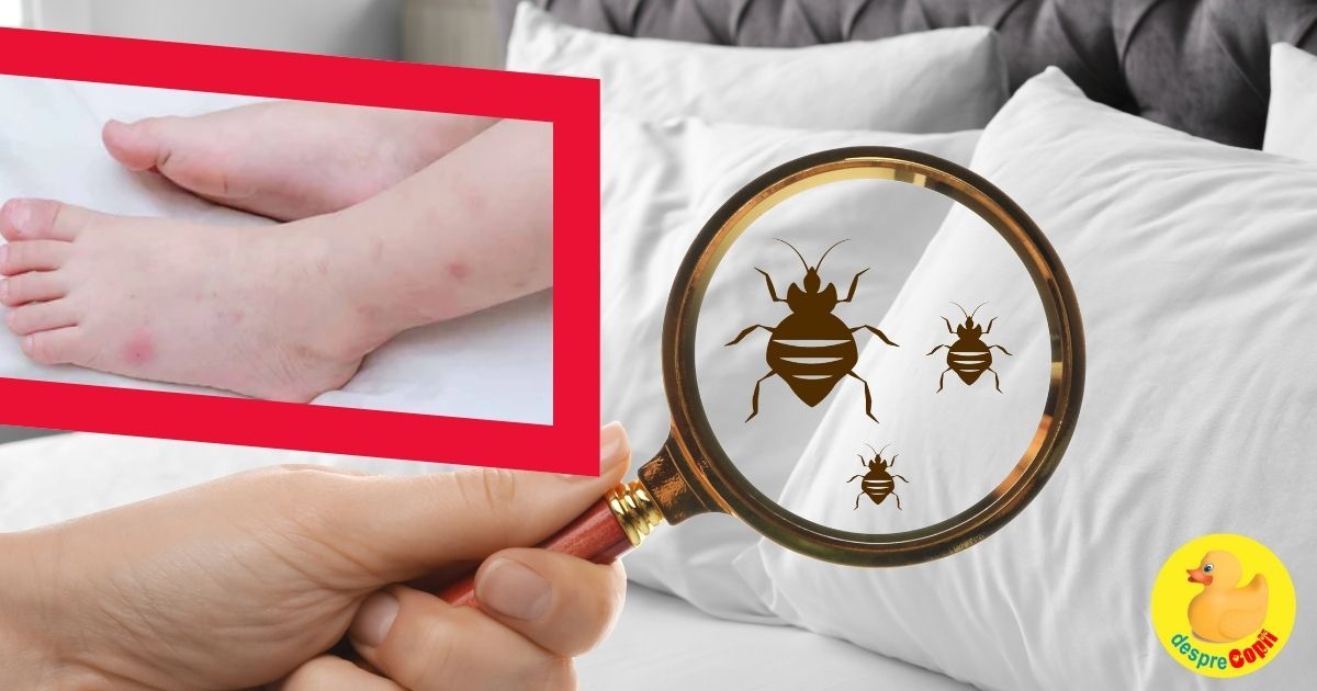 Bebe are pete rosii pe piele? Poate fi vorba de plosnite. Cum le identifici, cum calmezi pielea si cum le elimini definitiv - cum îți protejezi copilul și casa