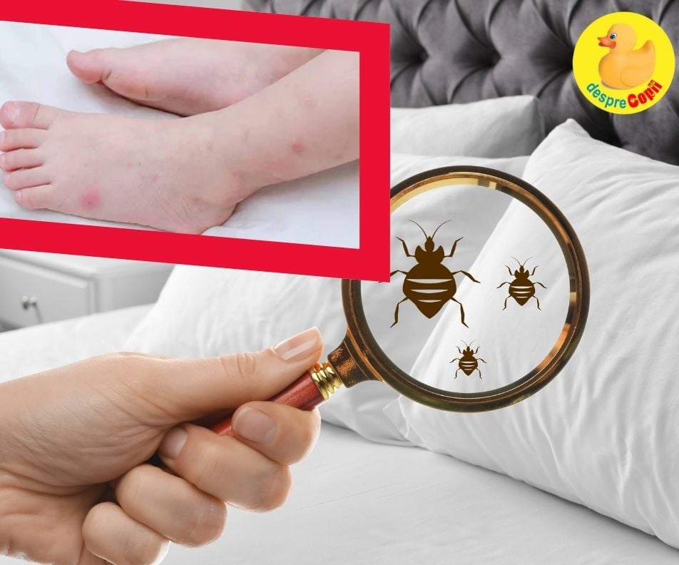 Bebelușul are pete roșii pe piele? Poate fi vorba de ploșnițe. Cum le identifici, cum calmezi pielea și cum le elimini definitiv - cum ți protejezi copilul și casa