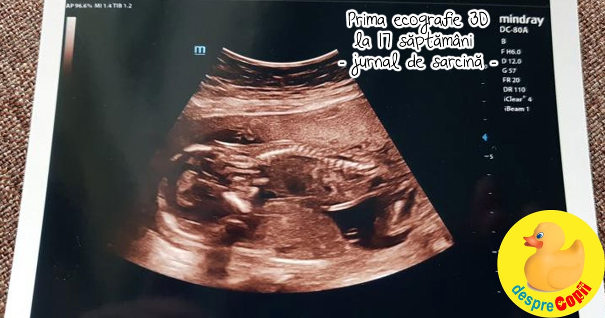Prima ecografie 3D la 17 saptamani si sexul copilului - jurnal de sarcina