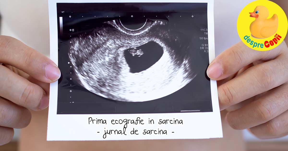 Prima ecografie din sarcina - jurnal de sarcina