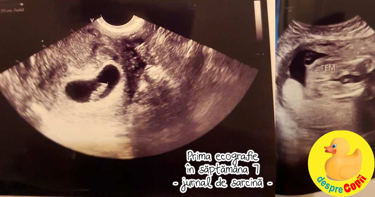 A treia sarcina: prima ecografie in saptamana 7 - jurnal de sarcina