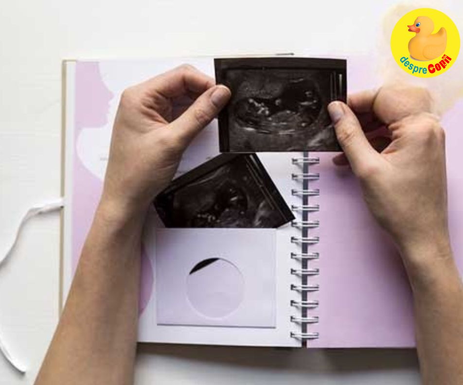 Emotiile primelor zile dupa ecografia din saptamana 5 cand nu e totul chiar perfect - jurnal de sarcina