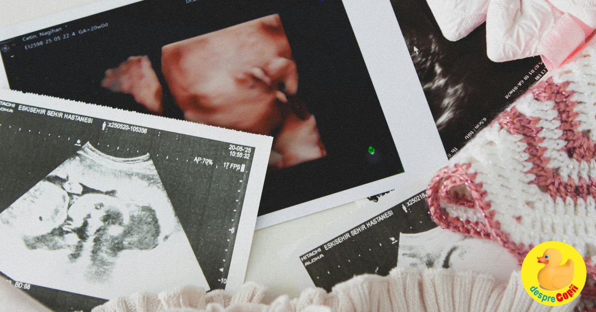 Prima ecografie a fost un dezastru cu final fericit -  jurnal de sarcina