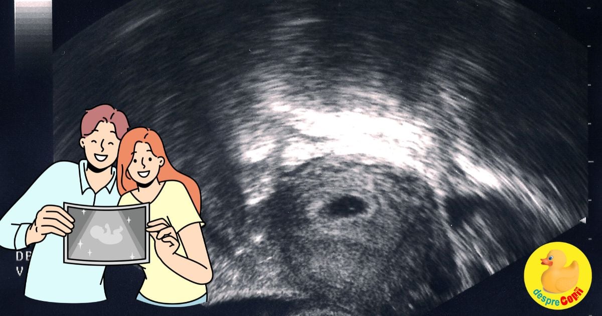 Prima vizita la medic si confirmarea sarcinii mult dorite - jurnal de sarcina