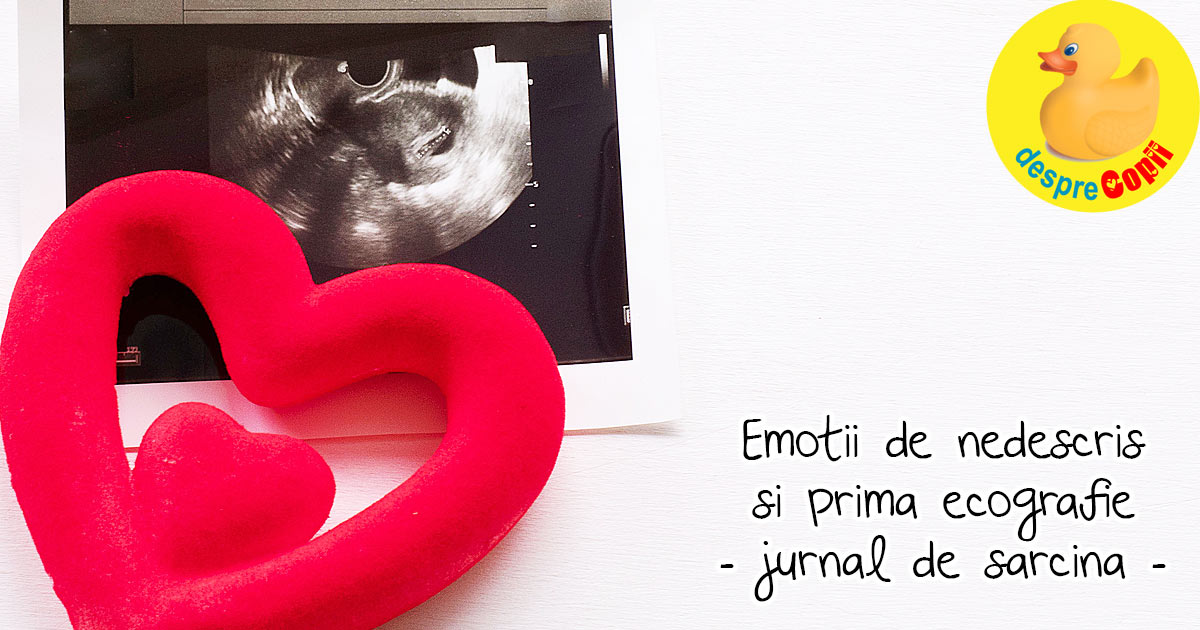 Un moment atat de emotionant -  prima ecografie - jurnal de sarcina