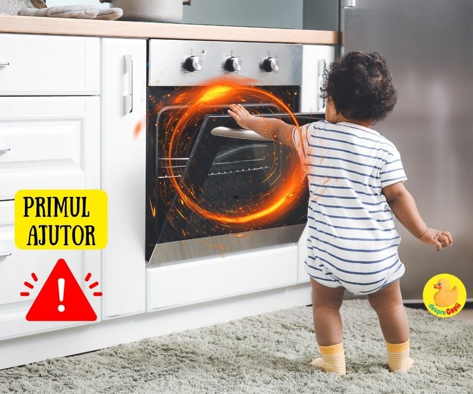 Primul ajutor cand copilul se opareste sau are arsuri pe piele. Atentie sa nu faci aceste greseli