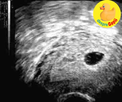 Fiecare sarcina este diferita deci nu va comparati cu altele. Doua sarcini, doua experiente - jurnal de sarcina