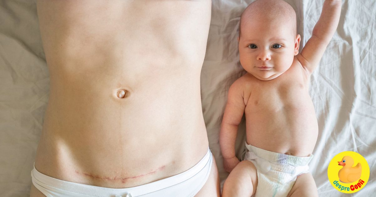 Asigurarea sanatatii digestive ai a imunitatii: Cum pot bacteriile lactice sa ajute bebelusii nascuti prin cezariana