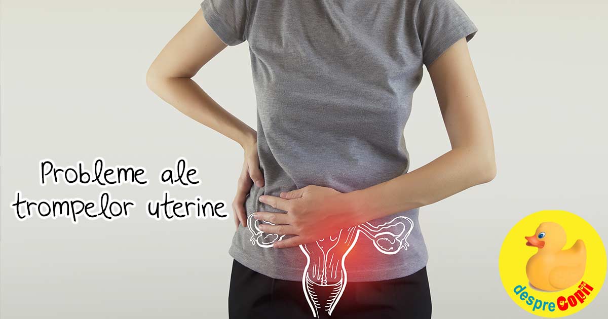 Probleme ale trompelor uterine - disfunctiile trompelor uterine