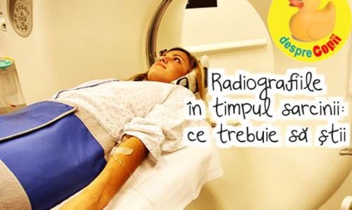 Sunt permise radiografiile in timpul sarcinii?