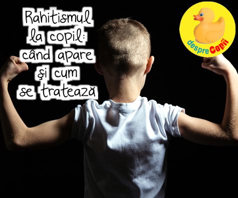 Rahitismul la copil: cand apare si cum se trateaza