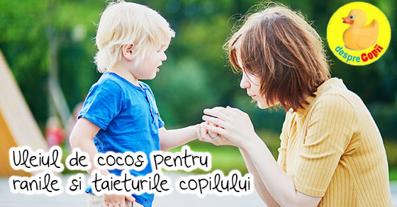 Foloseste uleiul de cocos pentru arsurile si ranile copilului