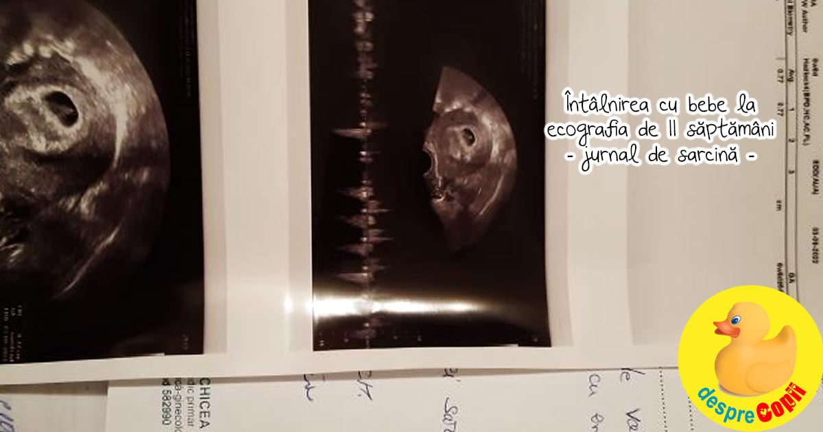Intalnirea cu bebe la ecografia de 11 saptamani - jurnal de sarcina