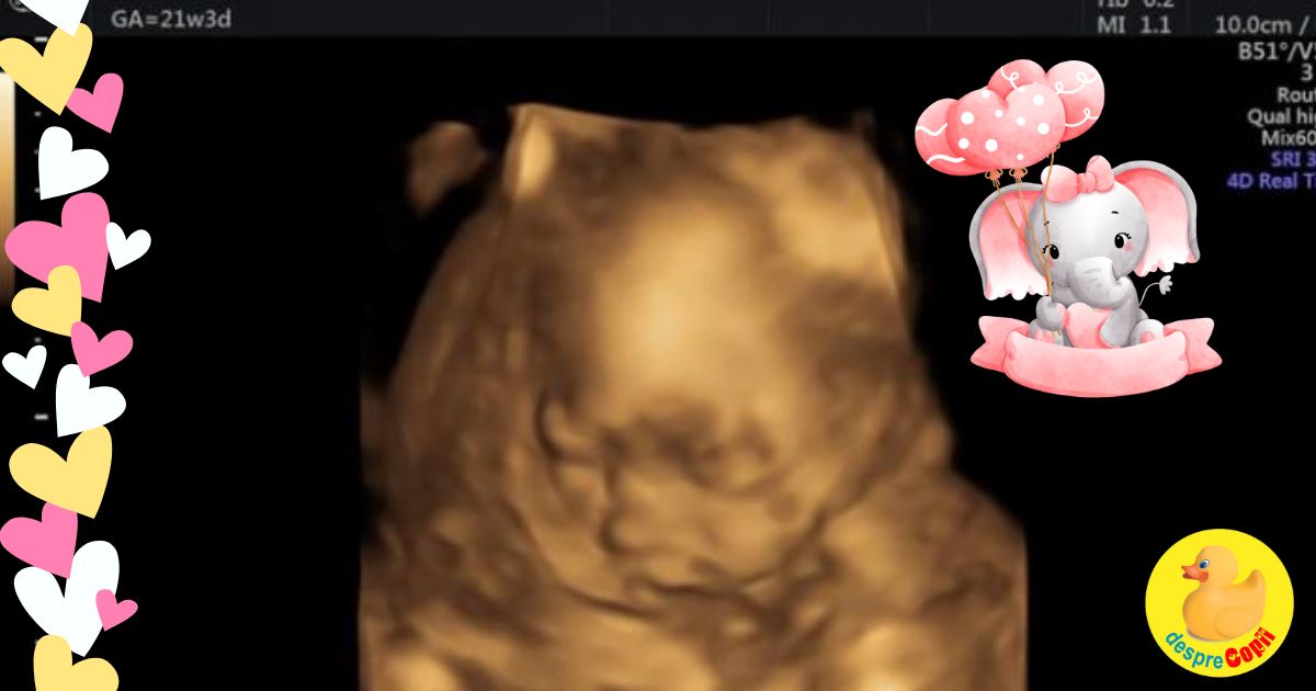 Saptamana 21 -  am aflat ca in urma unor complicatii urmeaza sa nasc prin cezariana - jurnal de sarcina