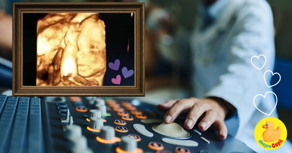 Saptamana 32: vesti bune la analize si un CD cu bebe in burtica - jurnal de sarcina