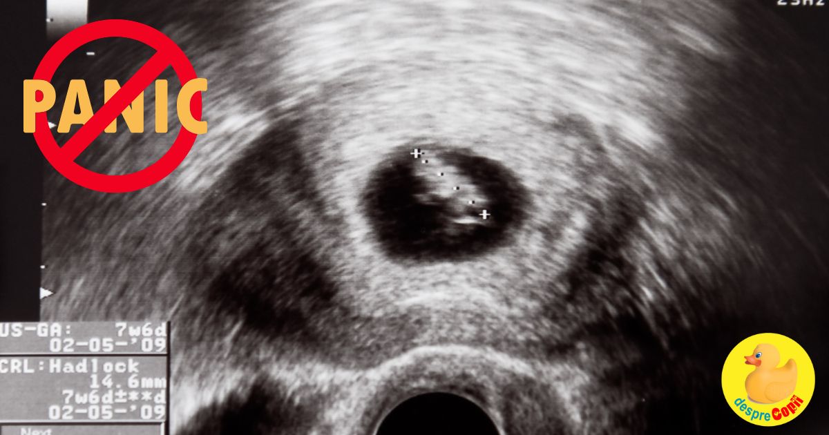 Saptamana 7 cu frica si panica: placenta era putin dezlipita - jurnal de sarcina