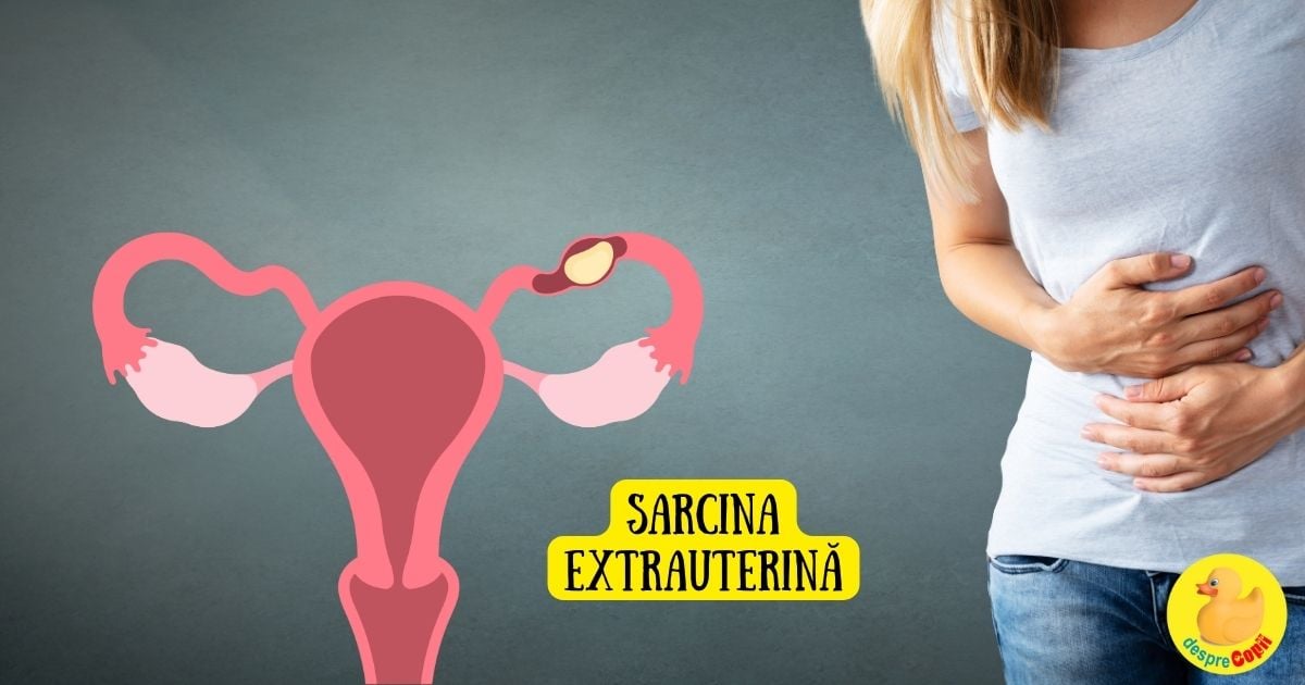 Sarcina extrauterina (ectopica) incepe ca o sarcina normala. Adevărul despre ingrijire si tratament - sfatul medicului