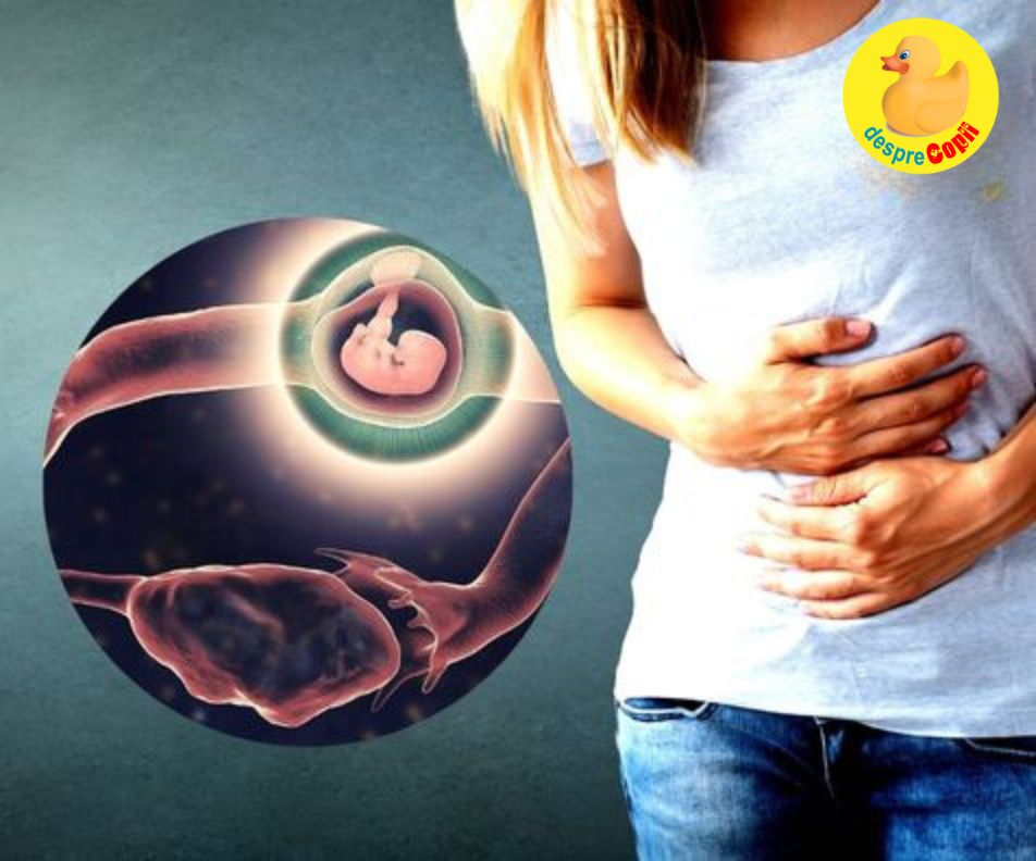 Sarcina extrauterina - factori de risc si variante de tratament - sfatul medicului