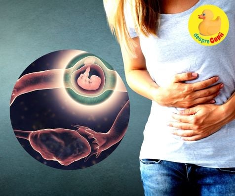 Sarcina extrauterina -  factori de risc si tratament - sfatul medicului