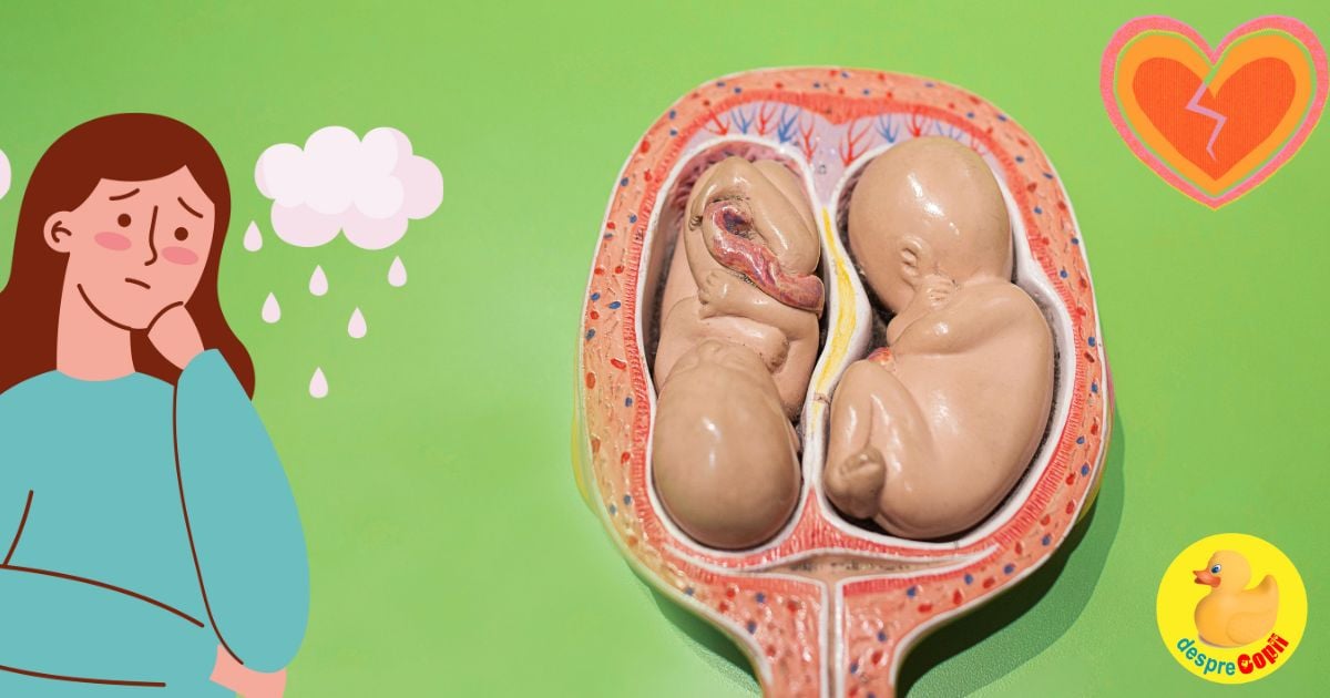 Saptamana 15 cu gemeni: am primit vestea ca un bebe are foarte putin lichid amniotic - jurnal de sarcina