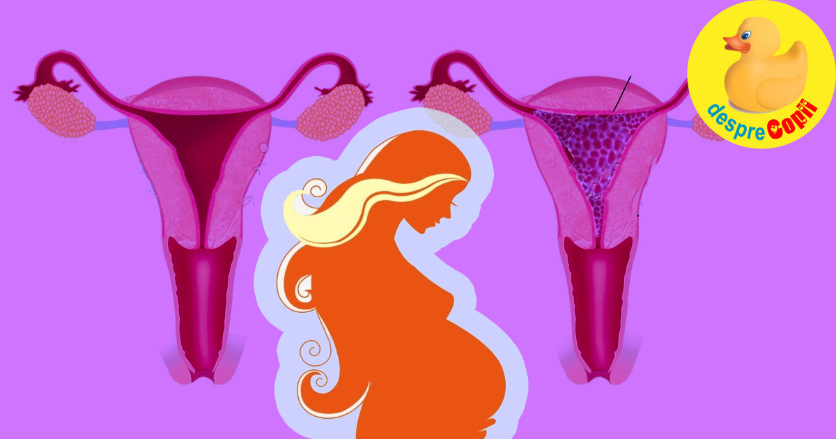 Sarcina Molara. Desi incepe ca o sarcina normala nu are sanse. Cauze si interventie.