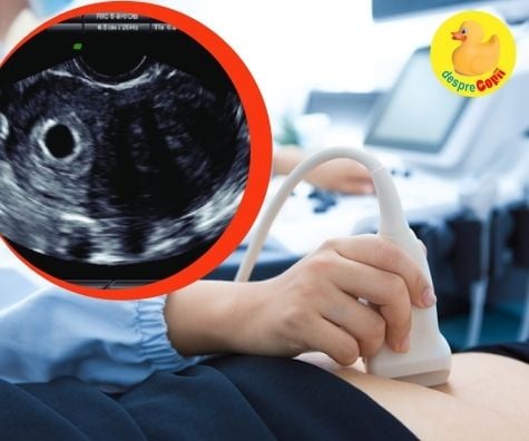 Sarcina fara embrion cu ou clar. Cauze, final si durere - ce e bine de stiut
