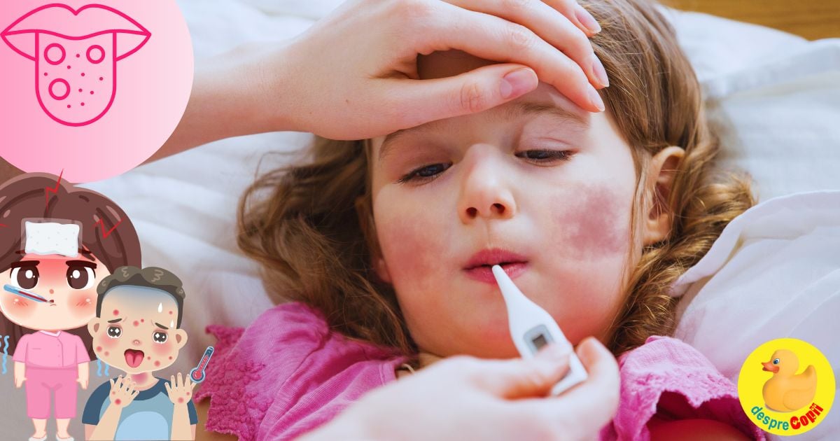 Scarlatina la copil. Ce simptome are, complicatii si tratament - sfatul medicului