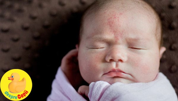 Semnele din nastere ale bebelusilor: de ce apar si cum le recunosti - GHID complet