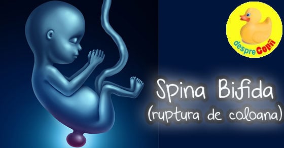 Spina Bifida sau ruptura de coloana la nou-nascuti: preventie, detectare, tipuri si tratament imediat
