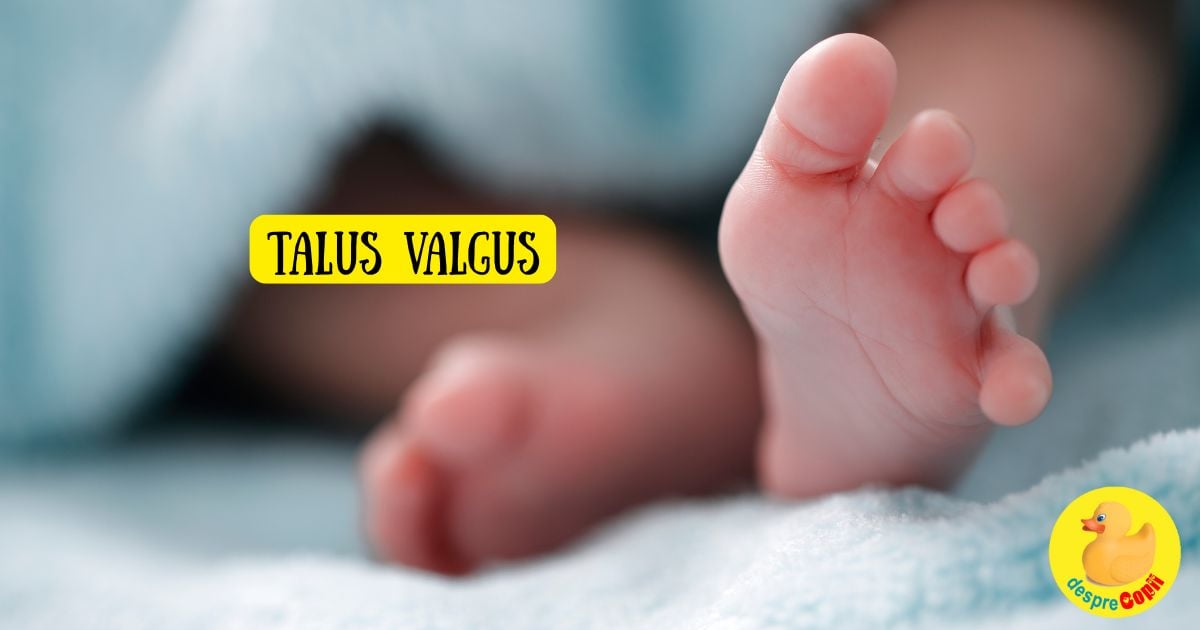 Bebelusul nascut cu piciorusele strambe? Se numeste talus valgus. Iata de ce nu trebuie sa intri in panica - sfatul medicului