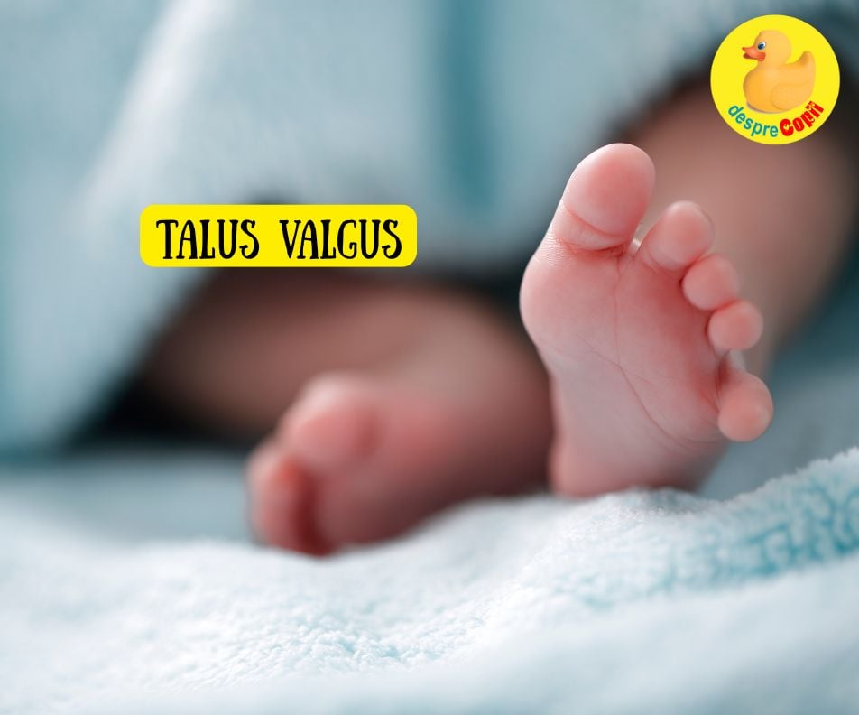 Bebelusul nascut cu piciorusele strambe? Se numeste talus valgus. Iata de ce nu trebuie sa intri in panica - sfatul medicului