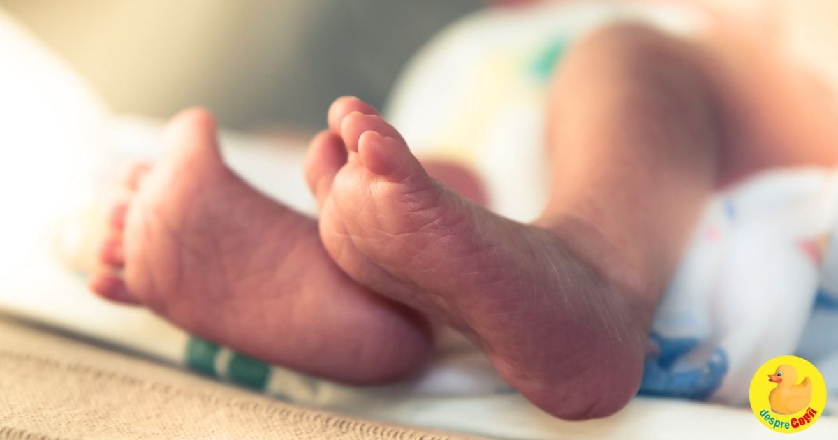 Bebe s-a nascut cu talus valgus la picioruse: simptome, cauze si tratament - sfatul medicului