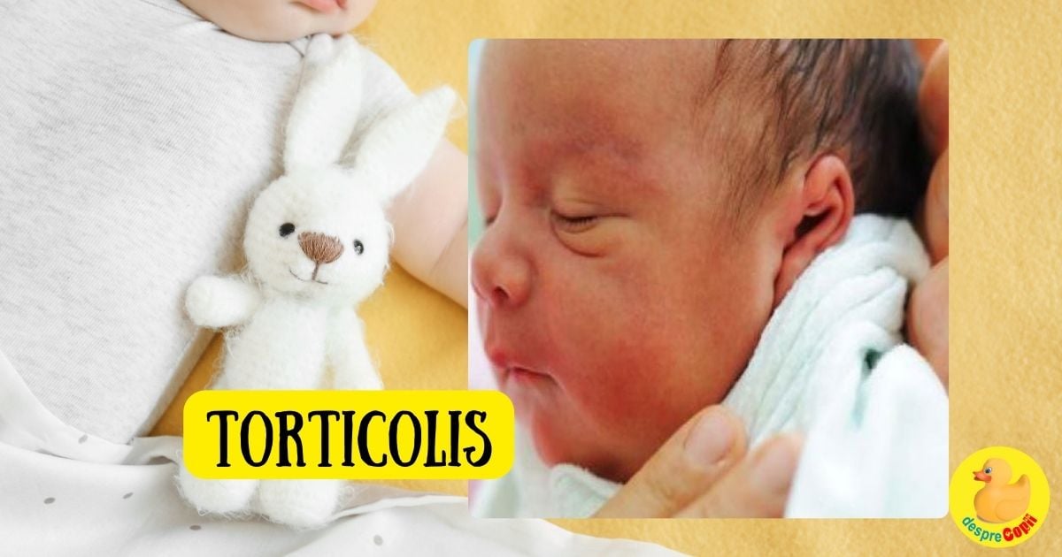 Torticolisul la bebelusi -  Tipuri si tratament - sfatul medicului