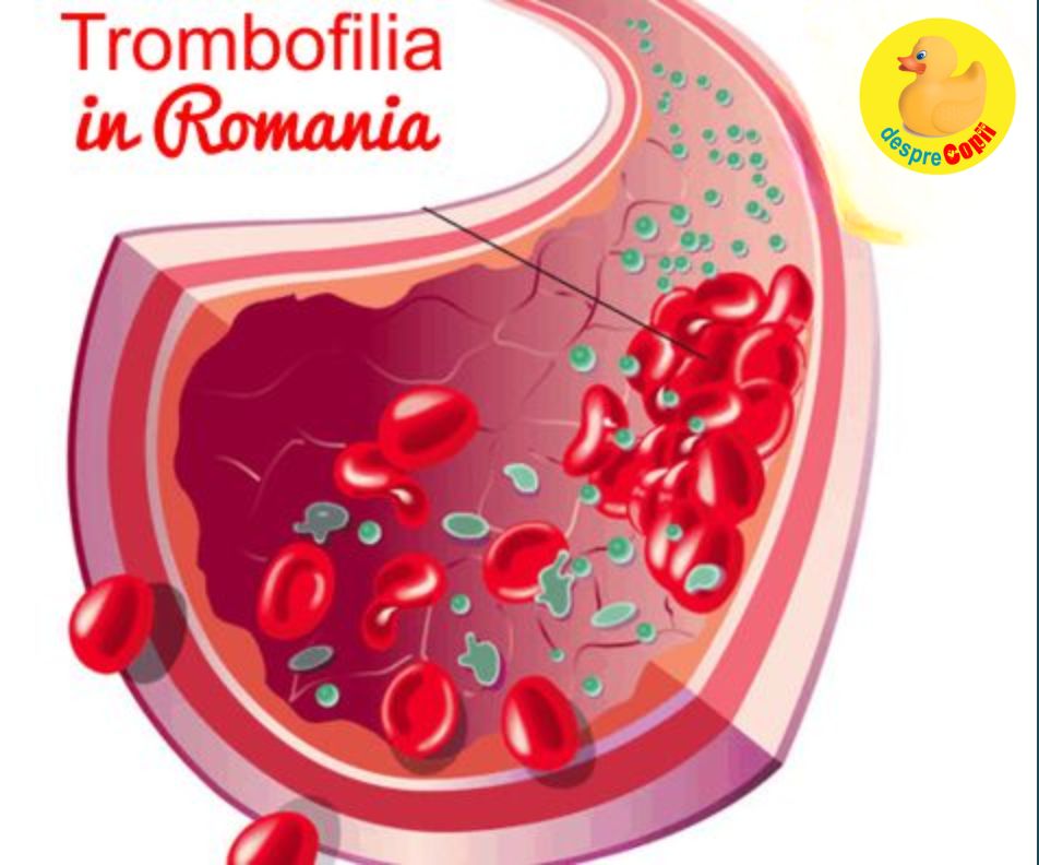 Ce este trombofilia si de ce pare sa fie atat de populara in Romania?