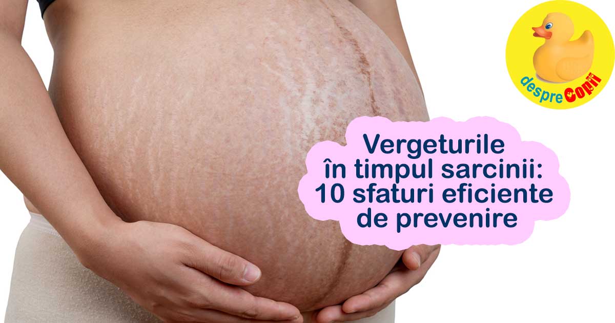 Vergeturile in timpul sarcinii -  10 sfaturi eficiente de prevenire