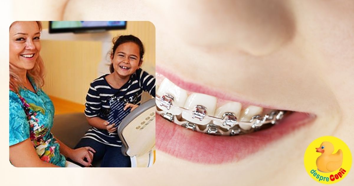 Prima vizita la medicul ortodont: vitala pentru dezvoltarea sanatoasa a copilului tau!